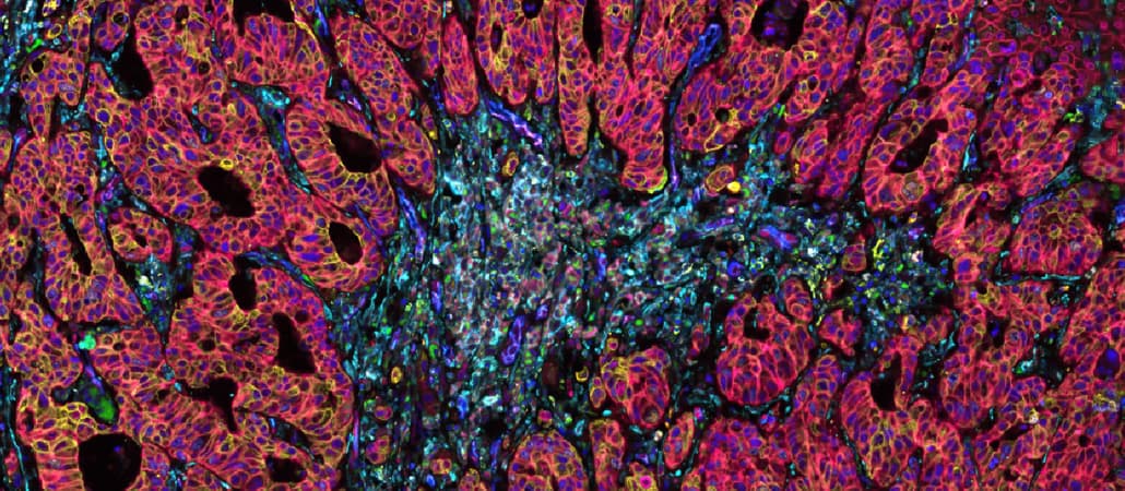 Discovering the secrets of cancer