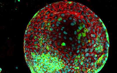 surface_marker_identifying_cancer_cells_resized_72