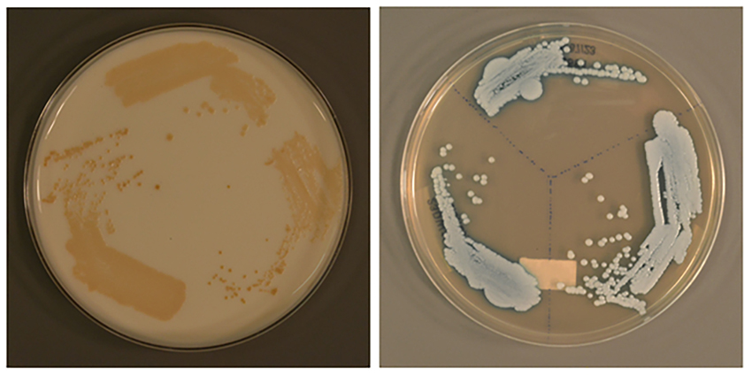 A Possible Global Public Health Threat_pix3