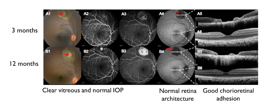 2020 12 15 Nature Biomedical Engineering- primate retinal (resized) 2020 12 15 Nature Biomedical Engineering- primate retinal (resized)