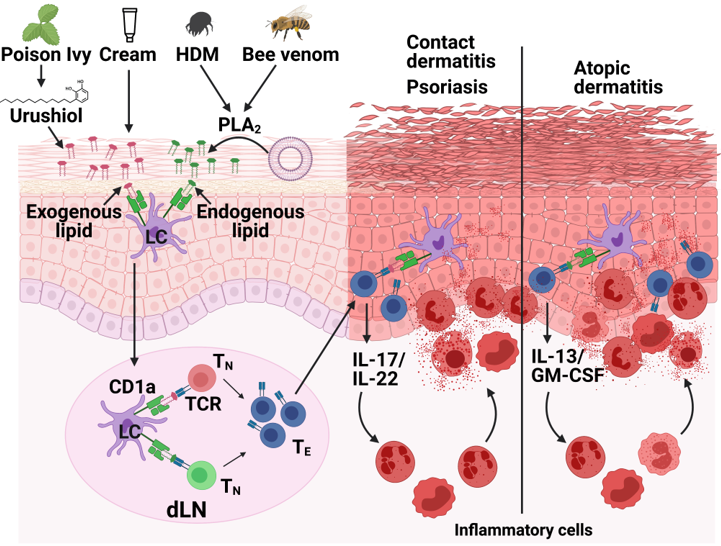 Figure 4: CD1a on Langerhans cells in skin inflammation