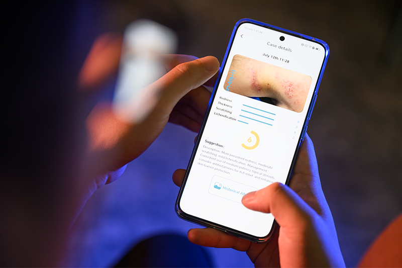 Leveraging AI to Help Eczema Patients Manage Their Condition