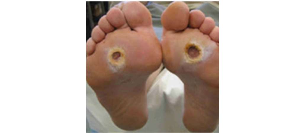 foot with hole-01-resized