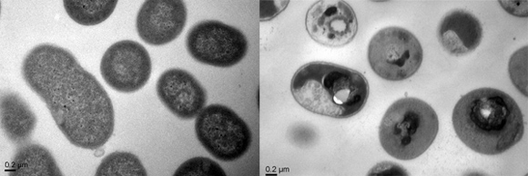 Normal cells of the Acinetobacter baumannii bacteria before and after