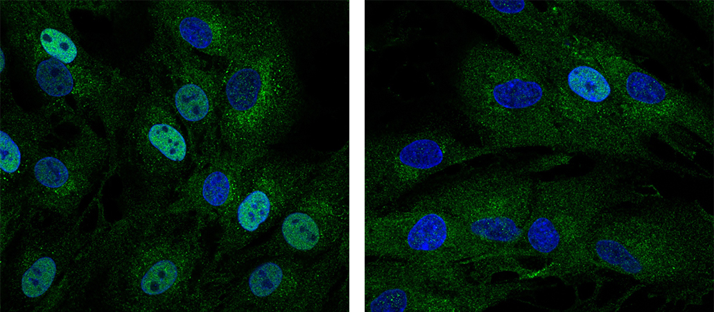 New immune pathway which results in immunodeficiency