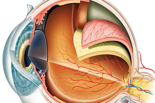 Medtech Vitreogel Innovations