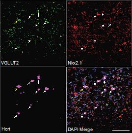 ASTAR_Finding The Cure For Common Metabolic Diseases In Singapore _FISH ASTAR Finding The Cure For Common Metabolic Diseases In Singapore