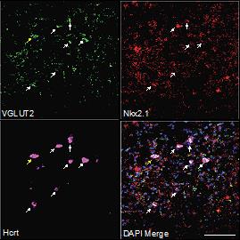 ASTAR Finding The Cure For Common Metabolic Diseases In Singapore