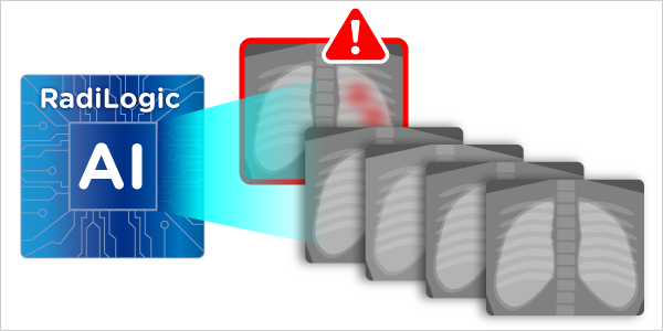 RadiLogic Infographic 600x300