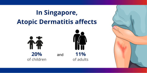 ASTAR_atopic dermatitis the search for answers_600X300