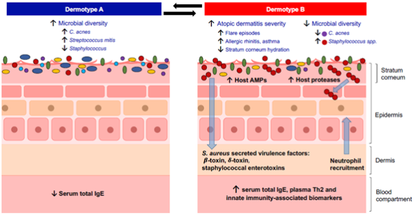 ASTAR_atopic dermatitis the search for answers_Dermotype A and B _1000X550