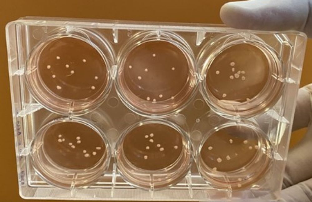 ASTAR_Scientists grow miniature brains_1000x650  