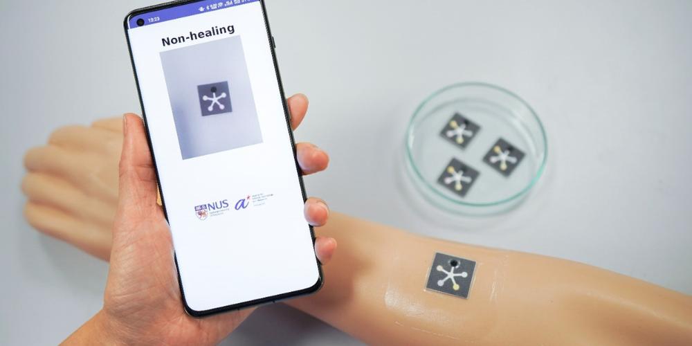 Innovative Paper-like, Battery-free, Ai-enabled Sensor For Holistic Wound Monitoring