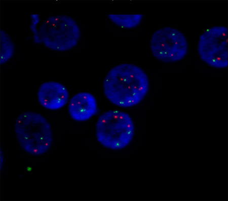 High number of the identified DNA biomarker (red)