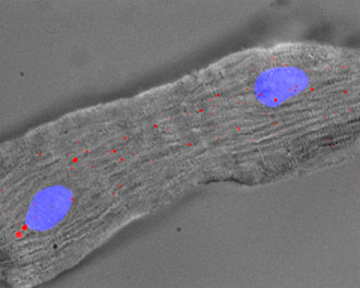 A mouse heart cell with 2 nuclei (blue) and Singheart RNA labelled by red fluorescent dyes.