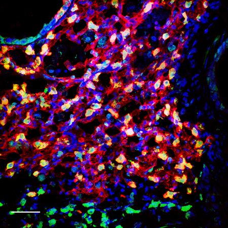 An image of the  injured mouse lung partially regenerated by injected lung stem cells