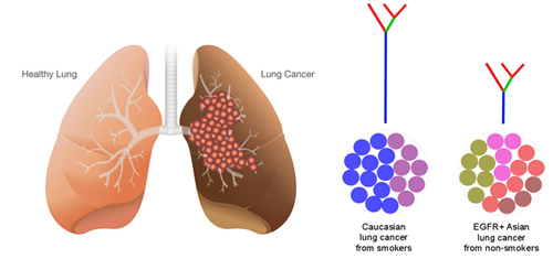 Researchers from Singapore discovered that the EGFR mutant lung cancer in Asians is more varied than its counterpart observed in Caucasians