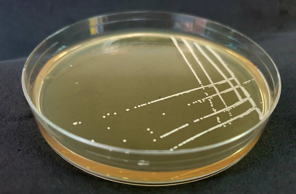 GIS-cultures of antibiotic resistant bacteria