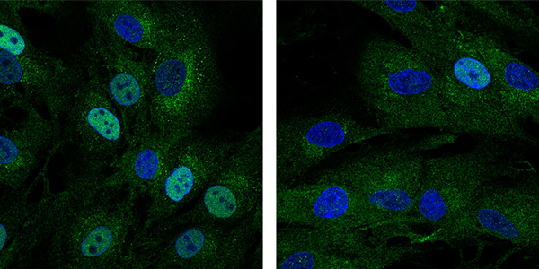 New immune pathway which results in immunodeficiency