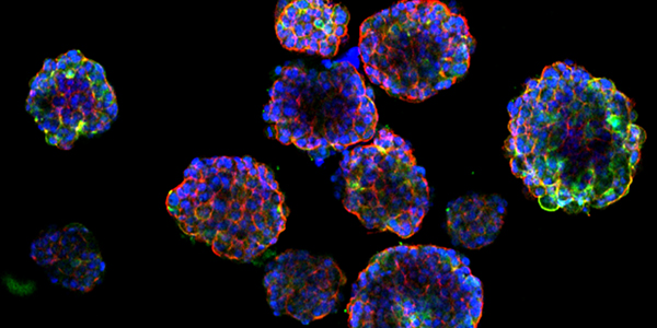 Staining of the epithelial markers integrin 600x300