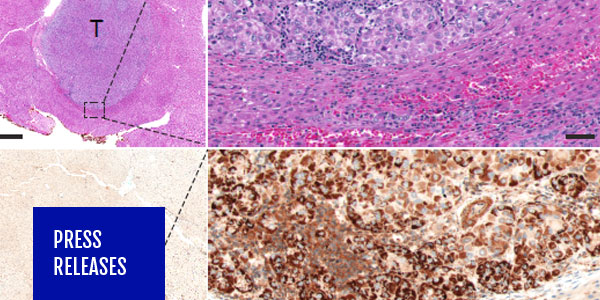 thumb-sbic-immunostaining