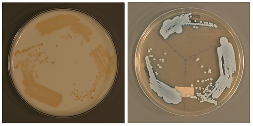 A Possible Global Public Health Threat_pix3 A Possible Global Public Health Threat_pix3