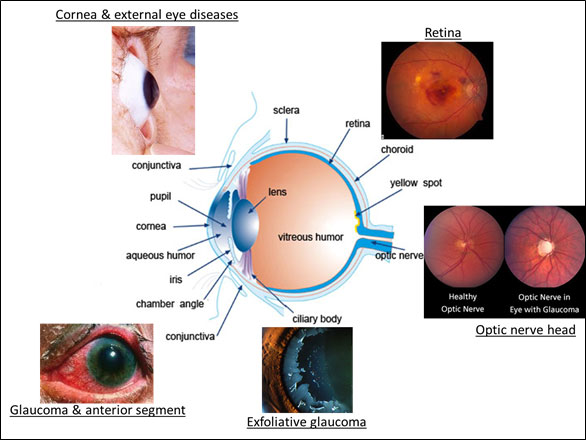 Different domains of eye diseases