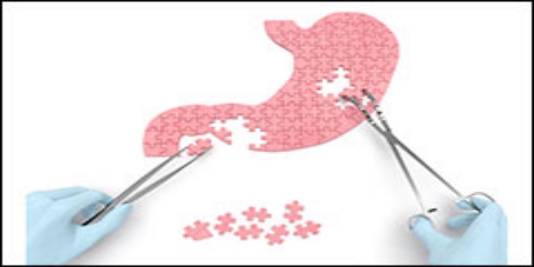 thumb_stomachcancermap - thumbnail