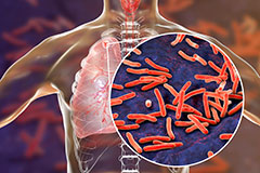 Weapons to fight tuberculosis