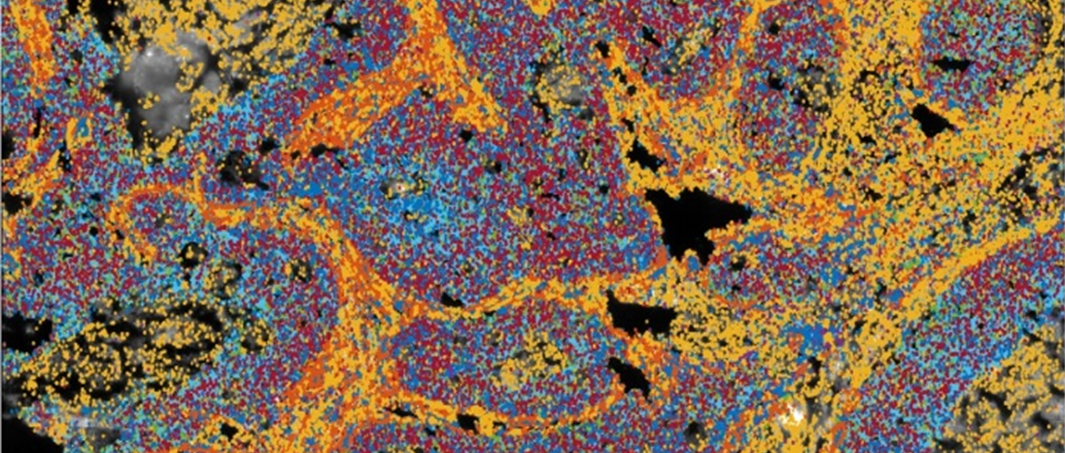 Spatial gene expression map in a colorectal tumour samplem crop