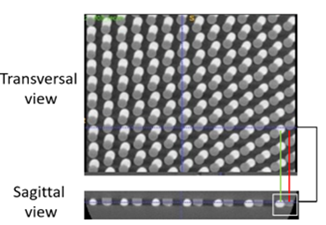 Defective Sample shown from transversal and sagittal view