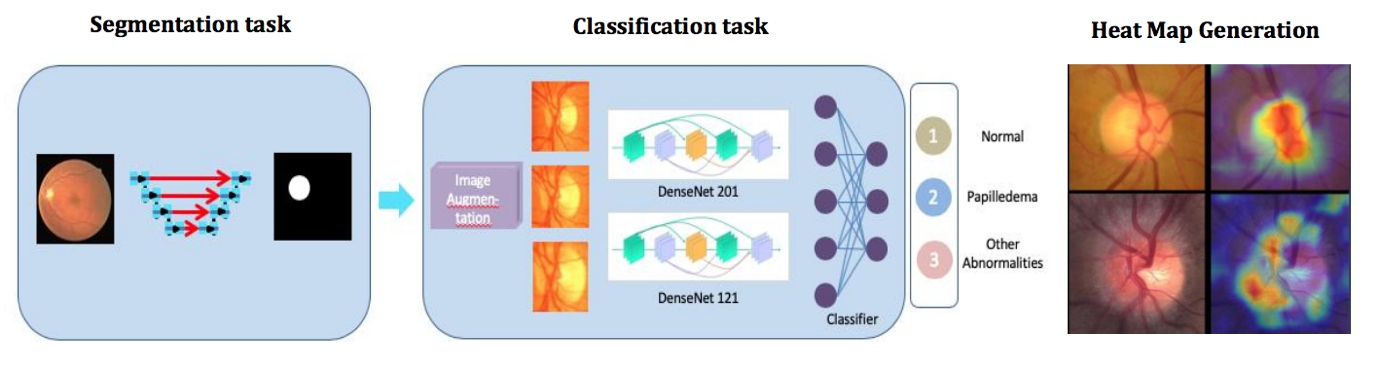 Architecture of AI model with segmentation and classification networks for papilledema detection