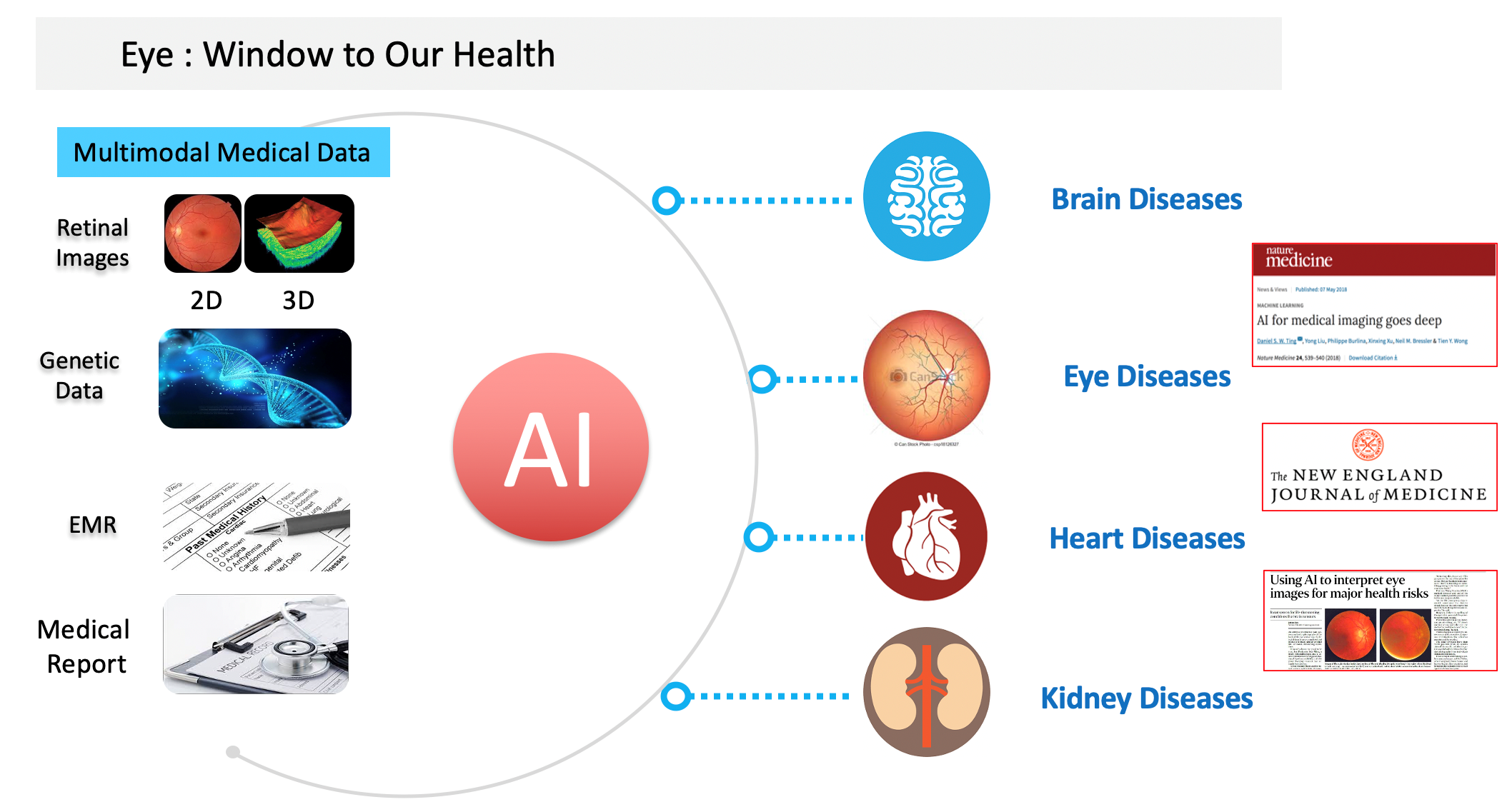 Multimodal AI for Ophthalmology