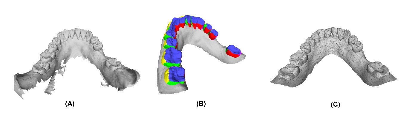 Surface Parameterisation of Dental Scan Model