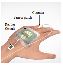 medtech wearable