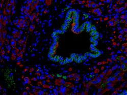 ittd_histo_8184_8201_new3