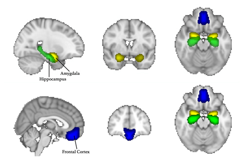 Brain diagram