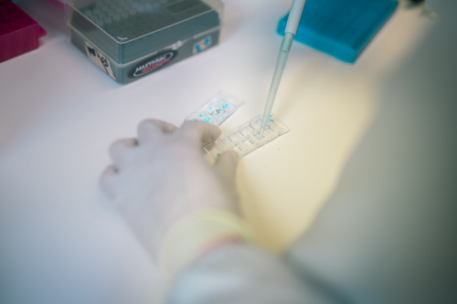 Oliver_Dressen_pipette_500px Oliver_Dressen_pipette_500px