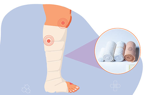 Pressure Sensors for Venous Leg Ulcers
