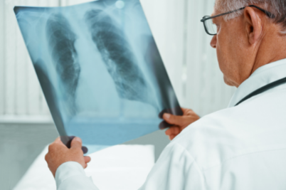 EDDC News_TOPNet-Lung TB