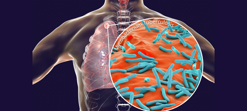 TB_TOPNet article image_1000x450 TB_TOPNet article image_1000x450