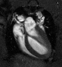 Rat_Cardiac_Long_Axis_Img